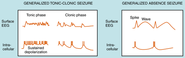 What is a tonic-clonic seizure?