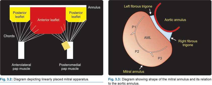 Mitral Stenosis - A Practical Approach to Clinical Echocardiography 1st