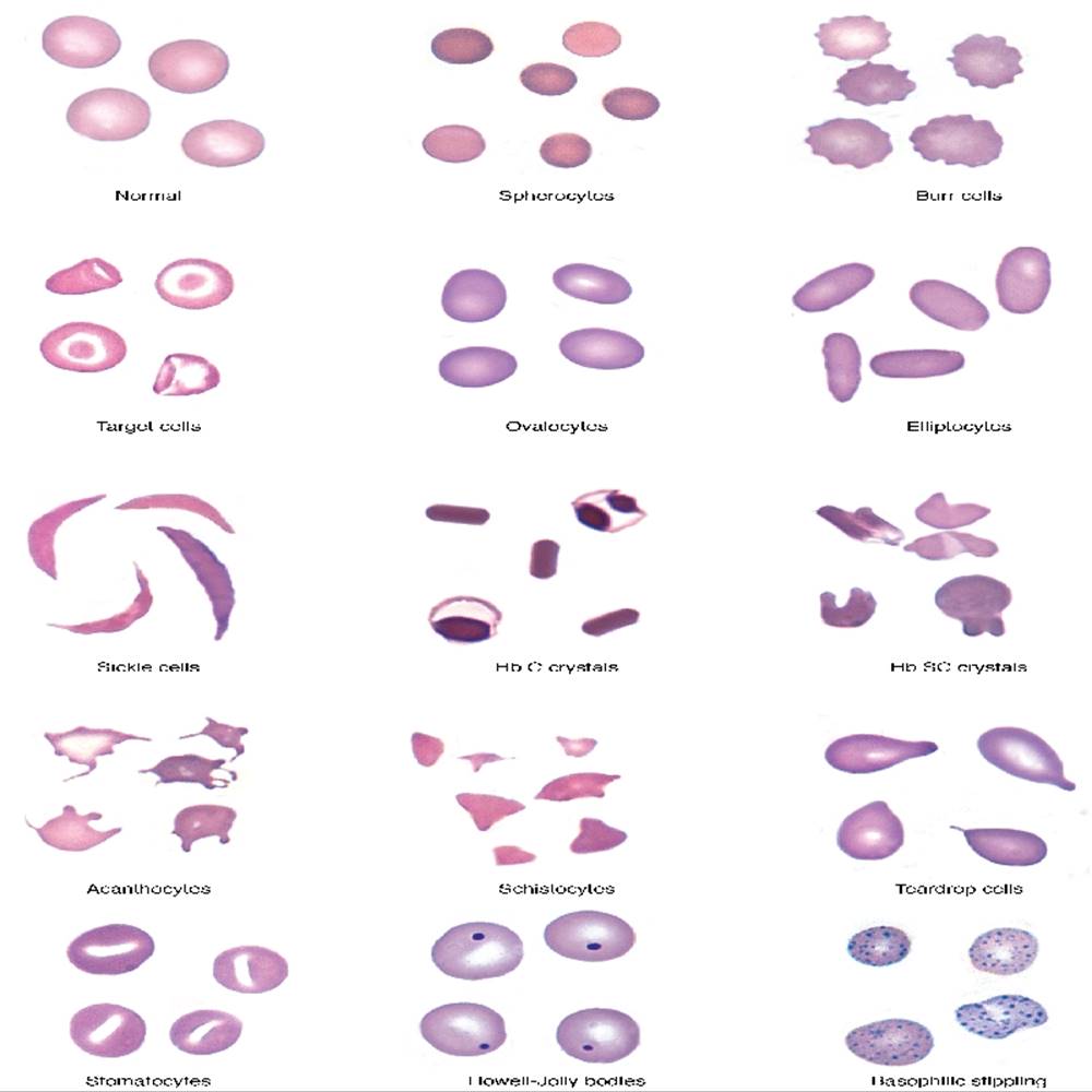 Blood Cell Morphology