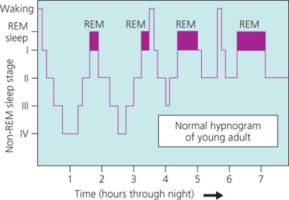 sleep asymmetry rem hypnogram