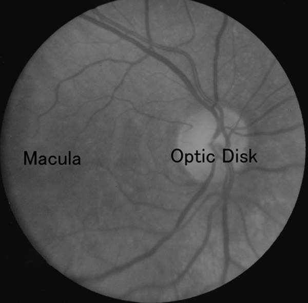 Figure 12.2—Retinal photograph of healthy retina
