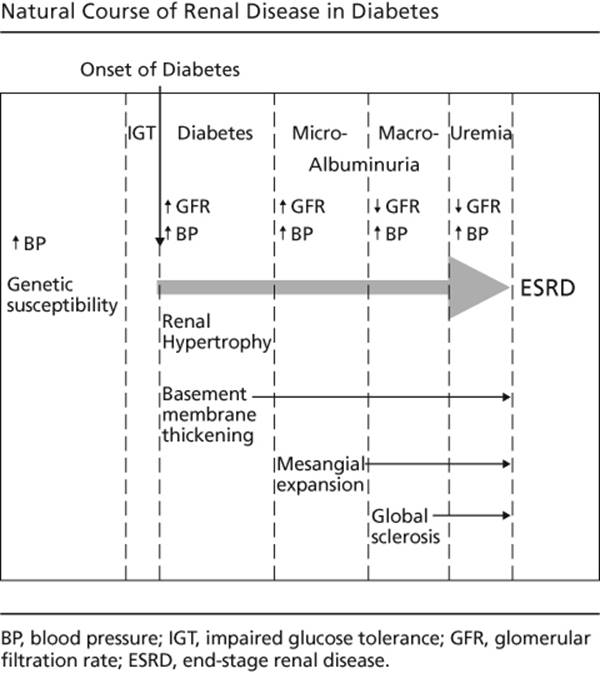 Figure 13.1—Natural course of renal disease in diabetes