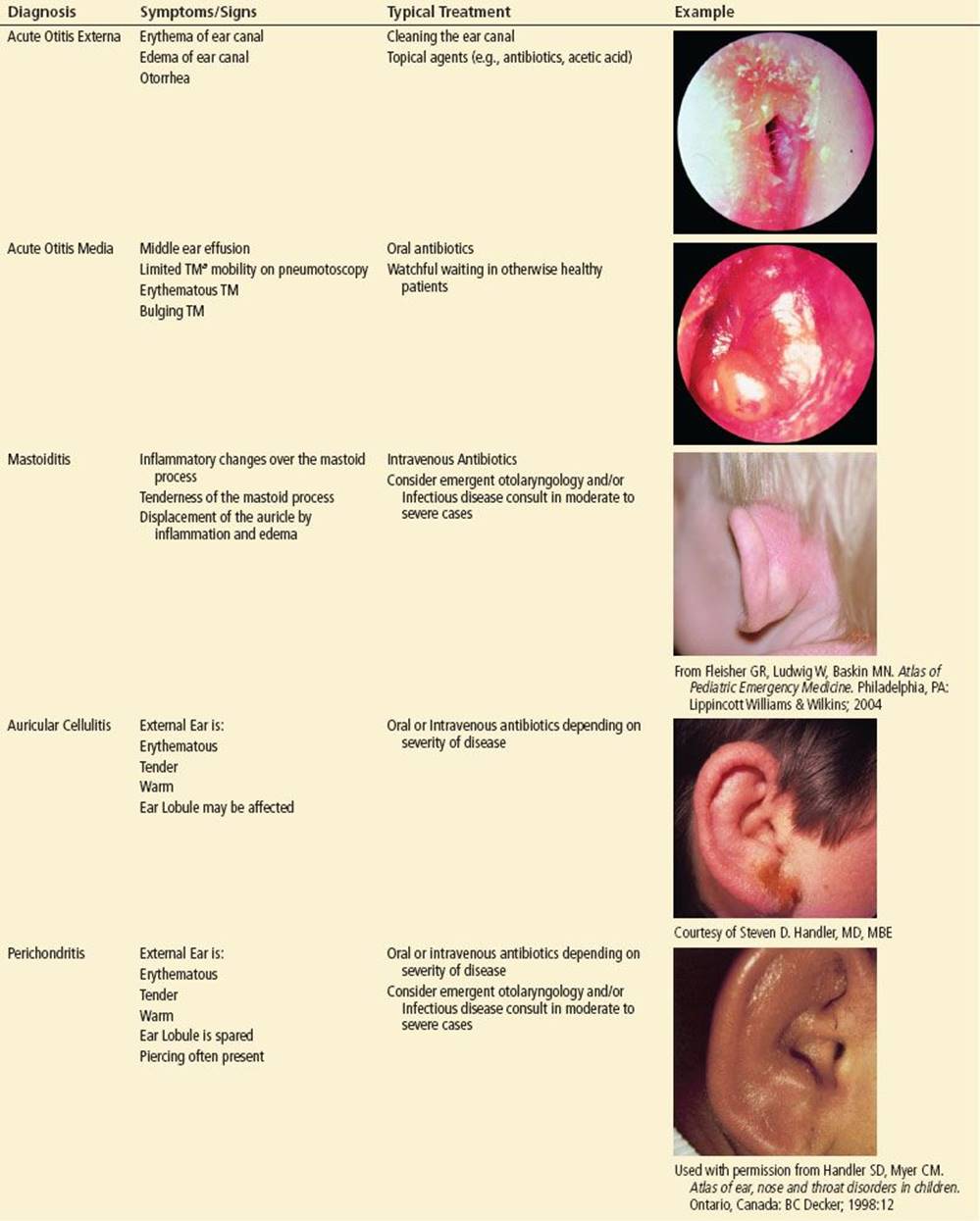 Middle Ear Conditions Chart 20x26 Middle Ear Ear Anat - vrogue.co