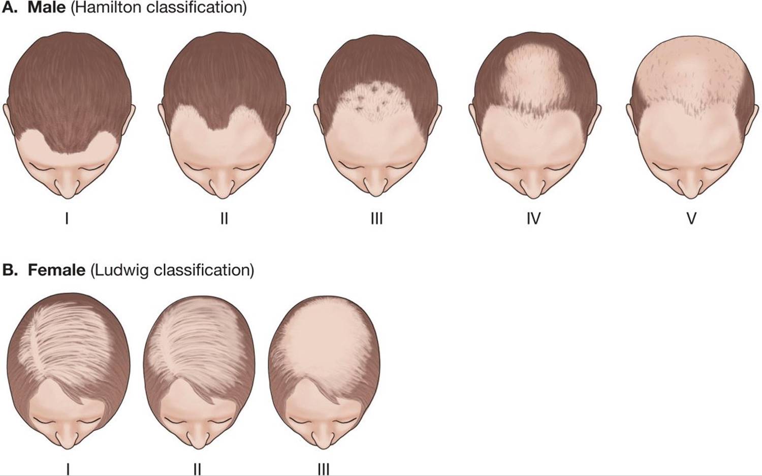 Disorders of Hair Follicles and Related Disorders - Fitzpatrick's Color  Atlas and Synopsis of Clinical Dermatology, Seventh Edition