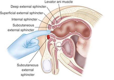 ORVOSI SZÓTÁR - Hypertrophy of uterus jelentése