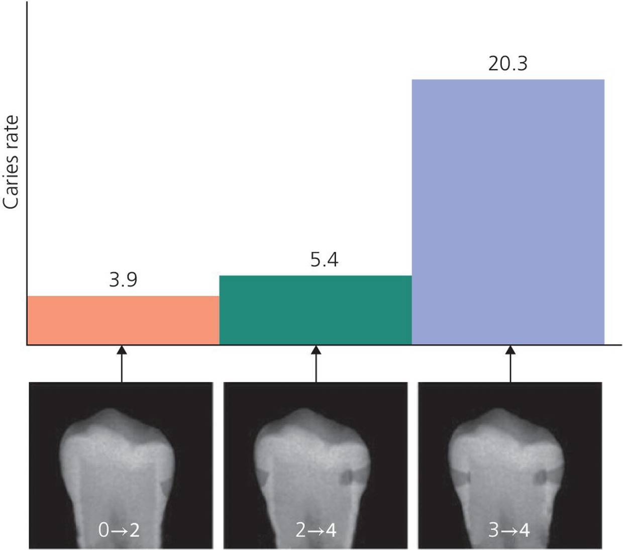 Three radiographs of a tooth illustrating the ninetieth percentiles of three progression states: from 0 to 2, from 2 to 4, and from 3 to 4.