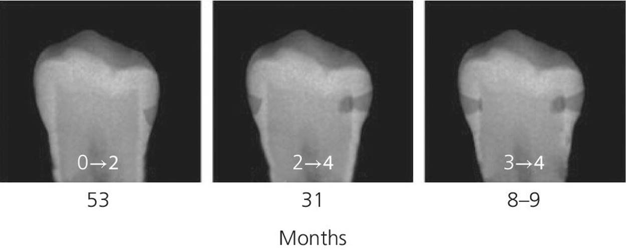 Radiograph of the teeth with median values of survival times from caries state 3 to state 4. It features 3.1, 3.9, 2.1, 3.4, 5.9, 3.6, 5.1, 3.3, 3.6, and two 2.8s.