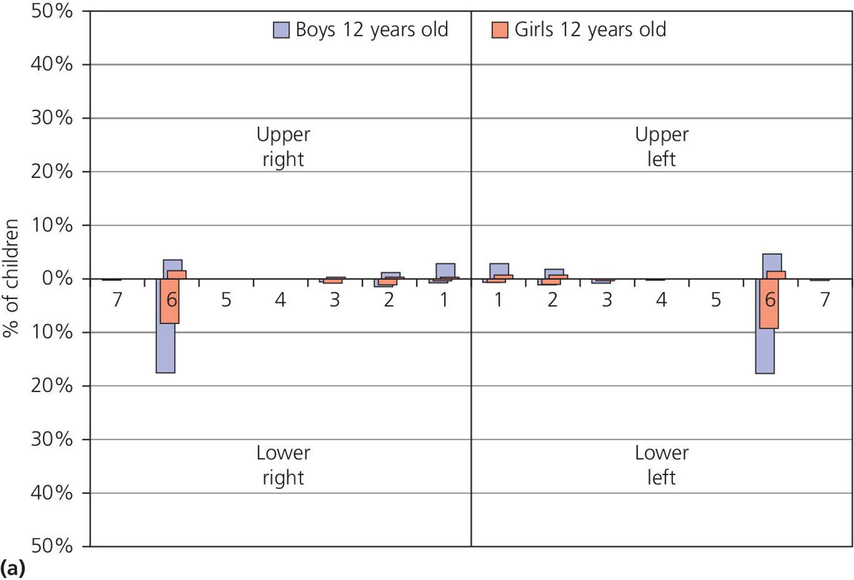 4 Quadrant bar graph displaying the percentage of boys and girls with dental erosion at 12 years of age. Bars for boys are higher than those for girls, particularly in the lower left and right teeth.