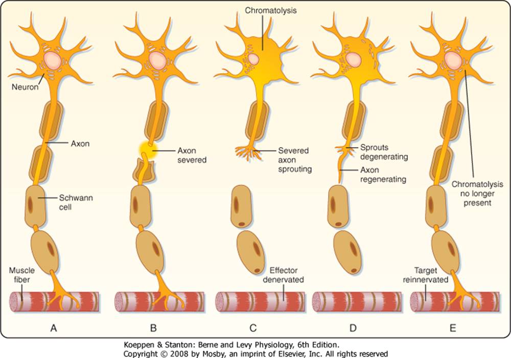 Дегенерация клеток. Схема регенерации нейрона после повреждения отростка. Регенерация нервного волокна схема. Регенерация нейронов гистология схема. Регенерация нервных волокон гистология.