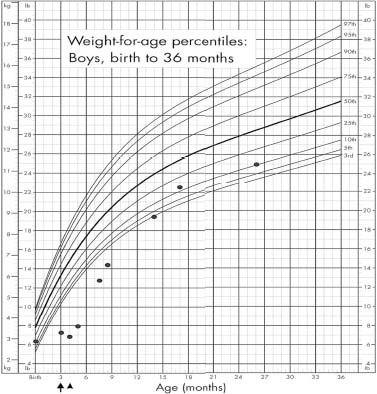 Premature Baby Weight Chart